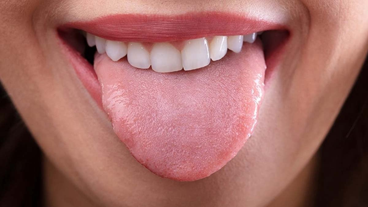 What is dry mouth? Why does it happen?