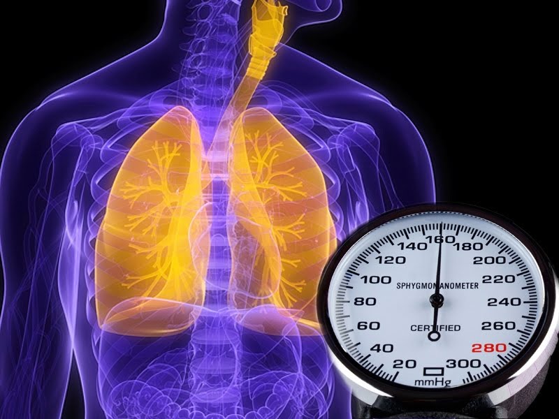 Akciğer hipertansiyonu nedir? #1