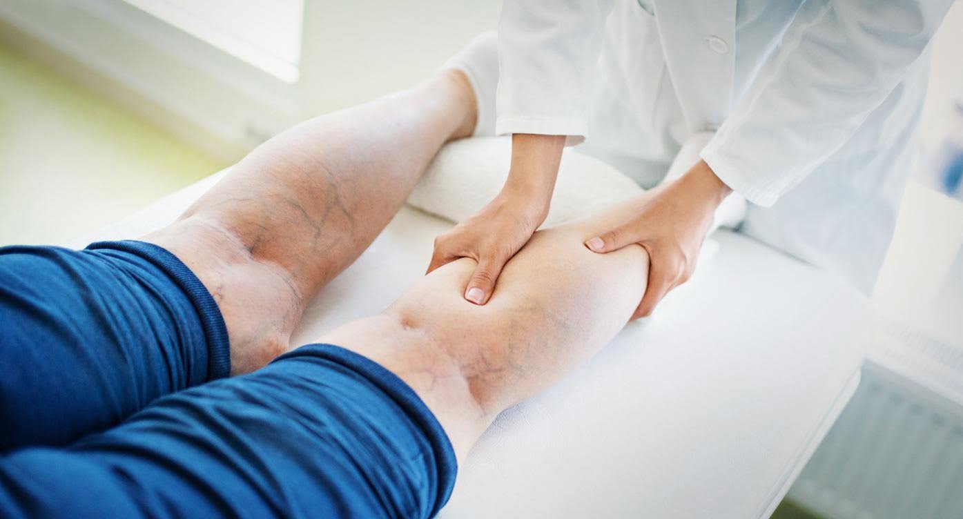 Bacaklarda geçmeyen ağrıların nedeni: Varis #2