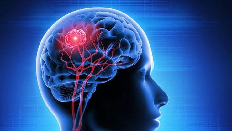 Beyin tümörlerinde psikoloji göz ardı edilmemeli #2
