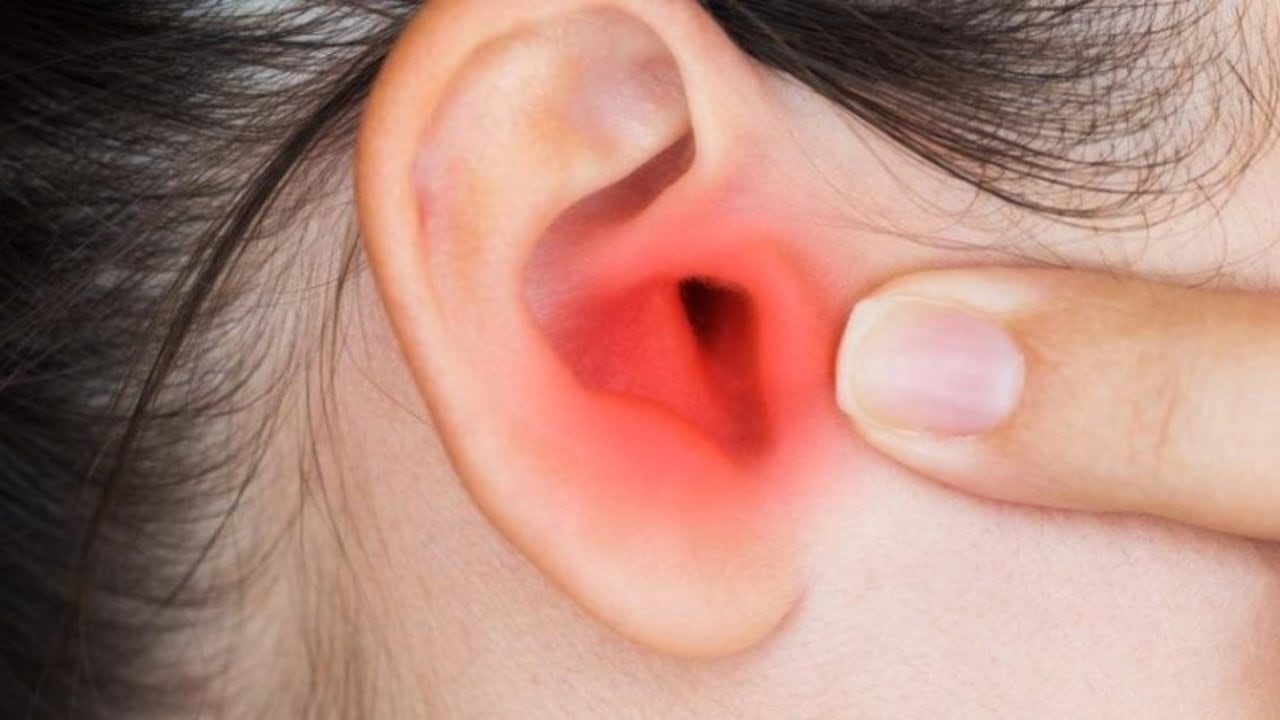 Çocuklarda orta kulak iltihabı #1