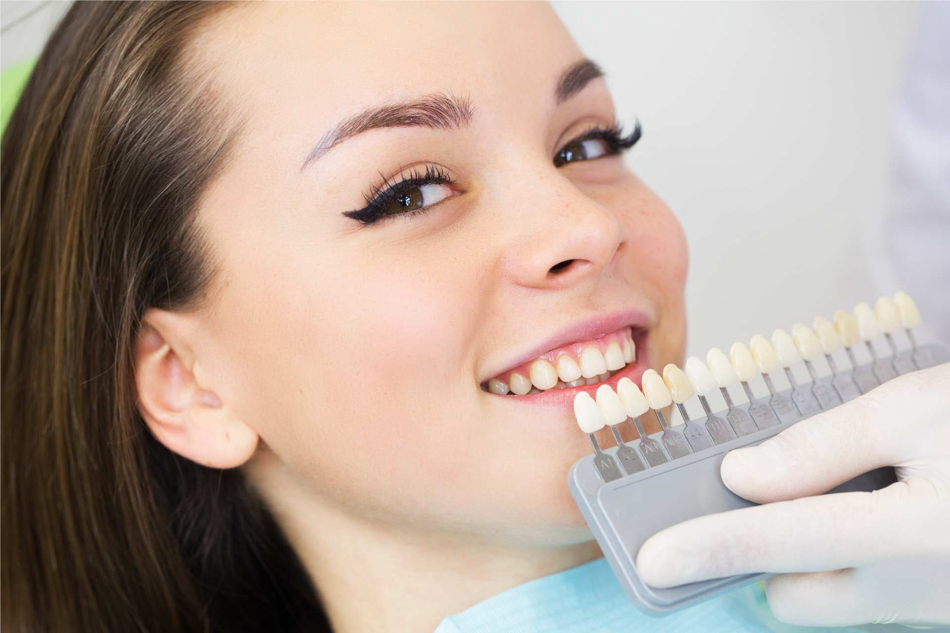 Diş beyazlatmak için etkili ve güvenilir tedavi: Bleaching #1