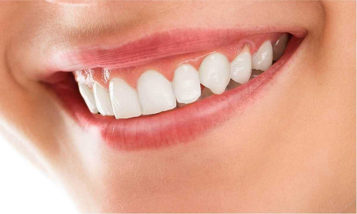 Vorsicht vor Zahnfleischerkrankungen