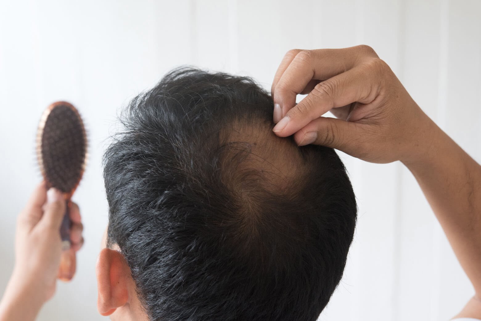 Günde 100 telin üzerinde saç dökülmelerinde önlem şart #1