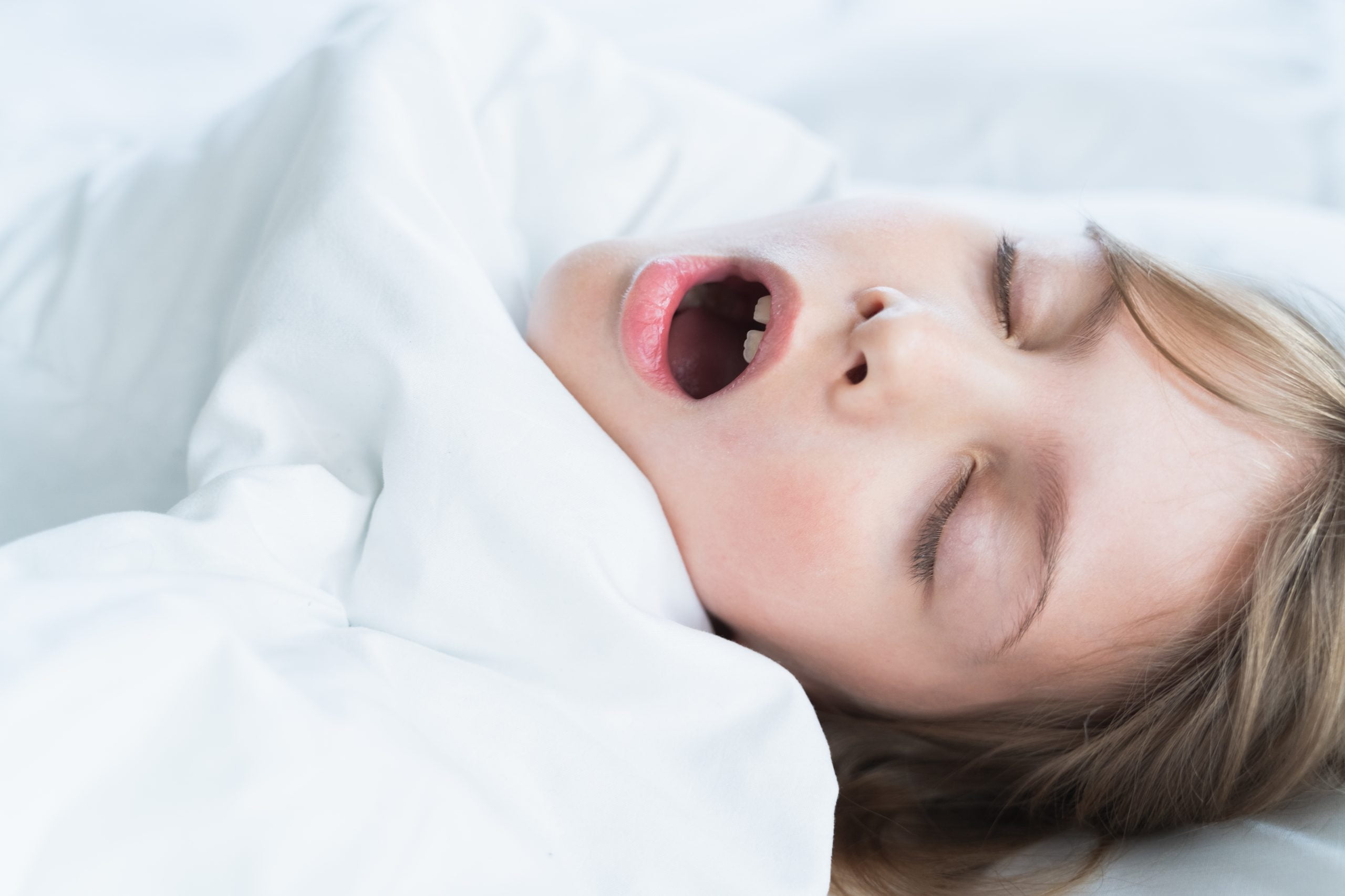 Haftada en az 3 gün horlayan çocuğa dikkat; uyku apnesi görülebilir #1