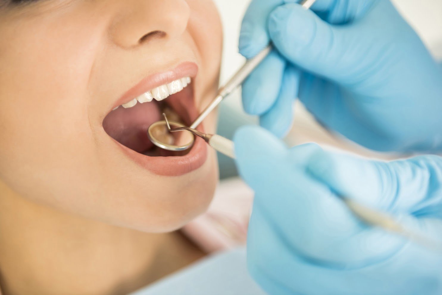 Kırık diş tedavi edilmezse apseye davetiye çıkarabilir #2