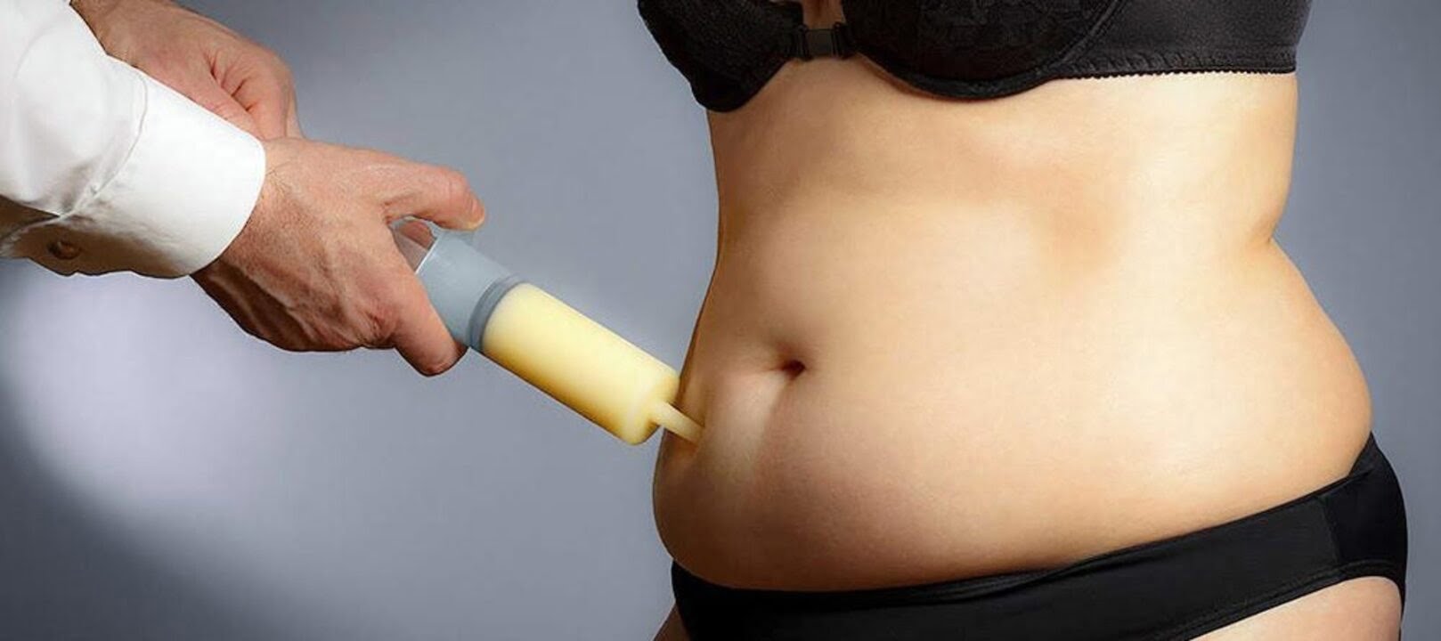 Liposuction uygulaması nedir? #2