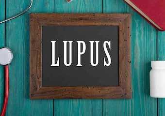 Lupus hastalığına dair her şey #7