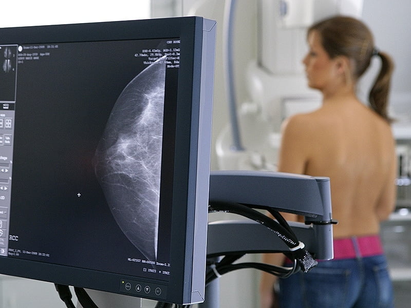 Mamografi taramasını atlamak hayati risk oluşturabiliyor #2