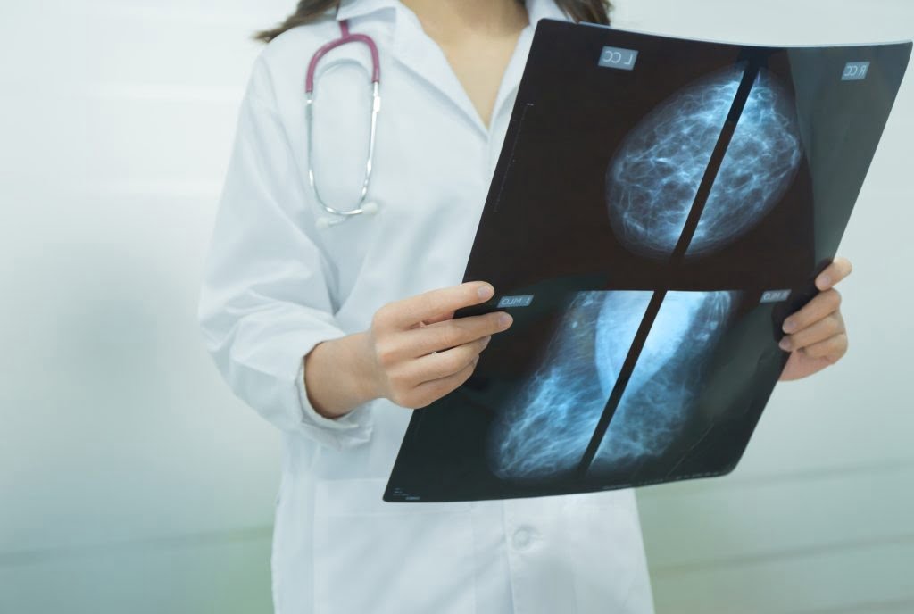 Mamografi taramasını atlamak hayati risk oluşturabiliyor #3