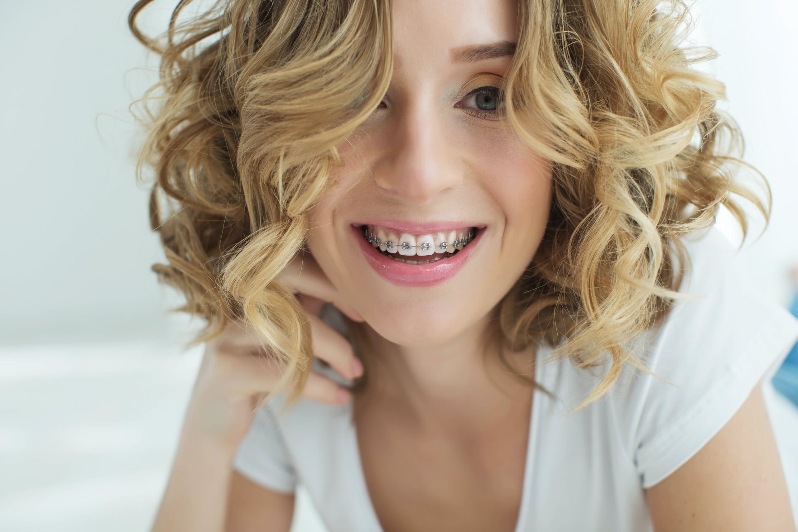 Ortodonti tedavisi hakkında merak ettikleriniz #2